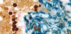 Enzyme Substrate Combinations 3 image 1