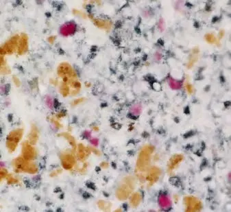 Enzyme Substrate Combinations 9 image 10