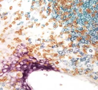 Enzyme Substrate Combinations 10 image 11