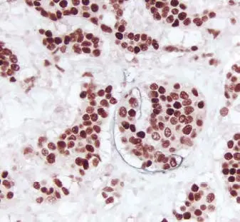 Enzyme Substrate Combinations 11 image 13
