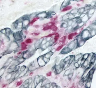 Enzyme Substrate Combinations 13 image 15