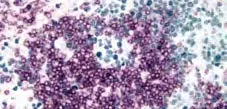 Enzyme Substrate Combinations 4 image 2