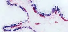 Enzyme Substrate Combinations 5 image 4