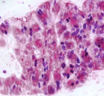Enzyme Substrate Combinations 6 image 5
