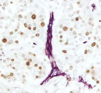 Enzyme Substrate Combinations 8 image 8