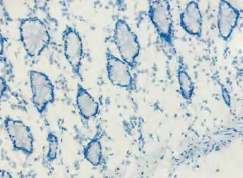 Blocking Background Signal 3 image 84