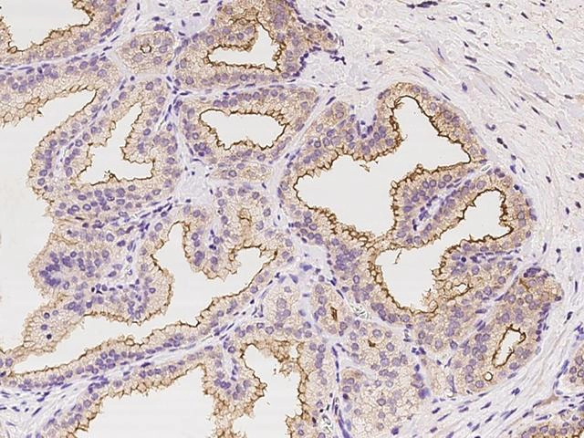 infectious disease pic1