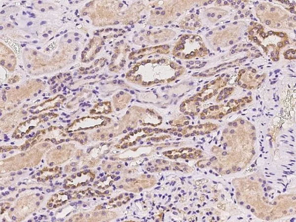 infectious disease pic2 600x450 1
