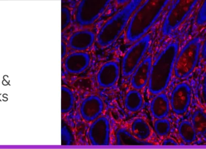 Glyco blog 1 tips and tricks header lg 1