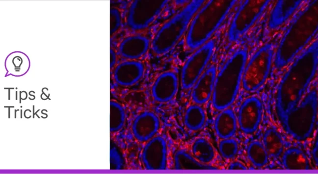 Glyco blog 1 tips and tricks header lg 1