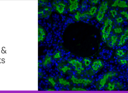 Glyco blog 2 tips and tricks header lg