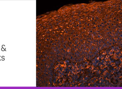 Glyco blog 3 tips and tricks header lg