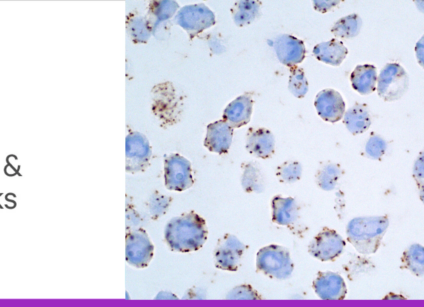 Glyco blog 4 tips and tricks header lg