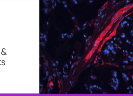 Glyco blog 5 tips and tricks header lg