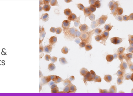 Glyco blog 6 tips and tricks header lg
