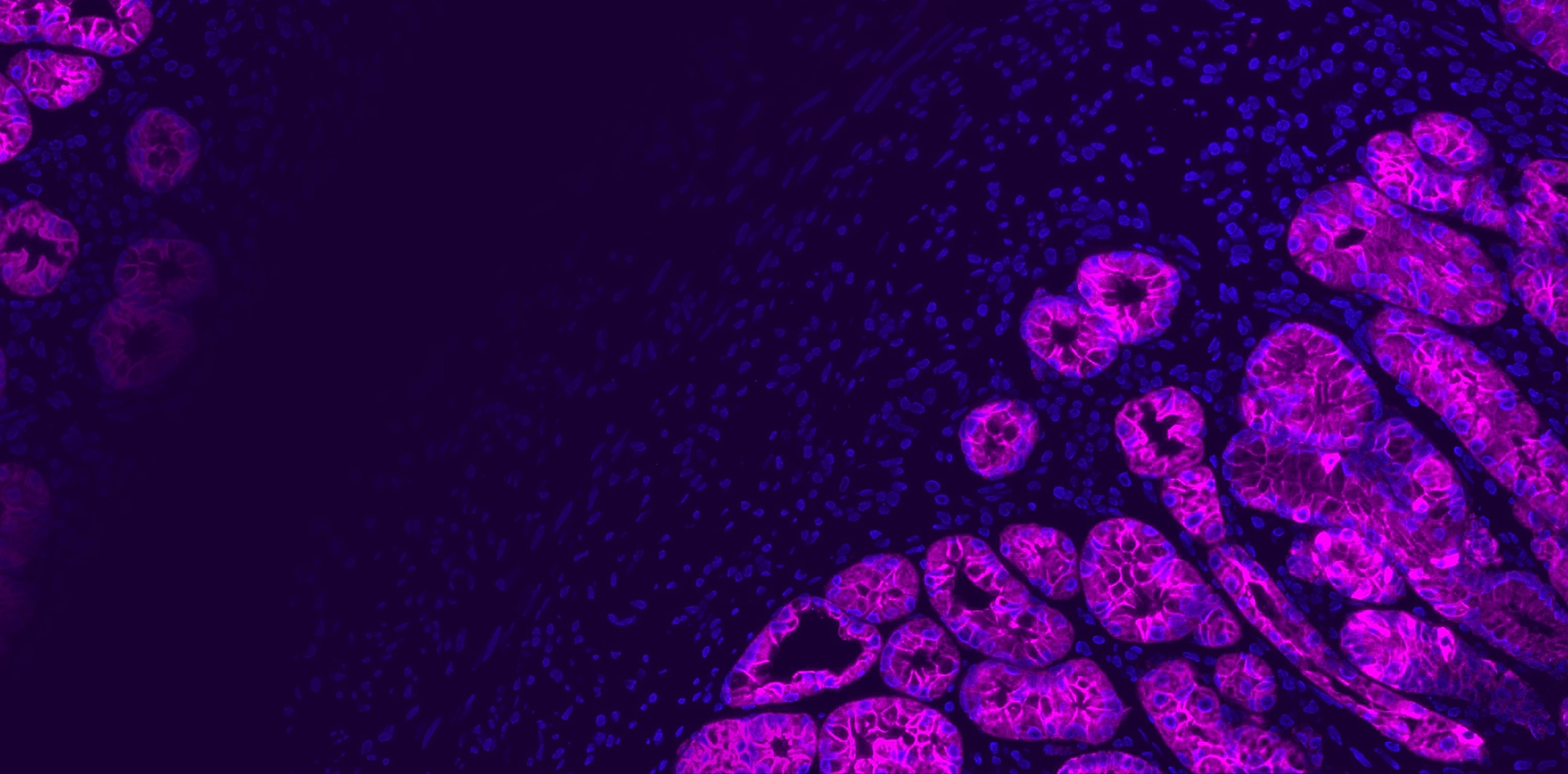 Immuno-Oncology 1 io hero bckgrd 2100x1037 01 1