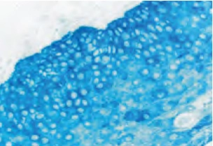 Tonsil Cytokeratin AE1 blue