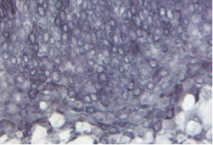 Tonsil Cytokeratin AE1 gray black