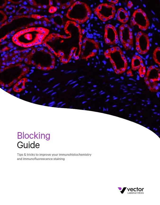 Blocking Guide Cover