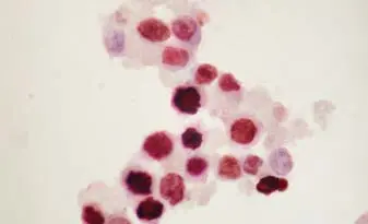 cytospin of ebv novared