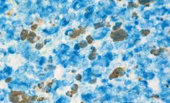 melanoma blue ap substrate