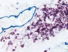 multiple antigen label colon