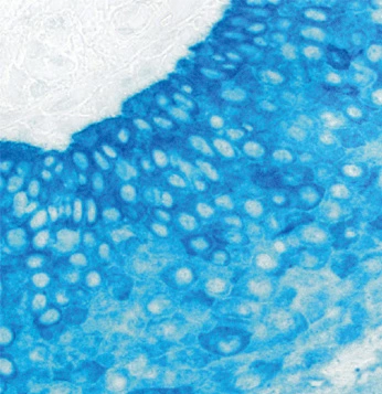 tonsil Cytokeratin blue