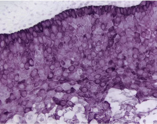 Tonsil: Cytokeratin AE1/AE3 (m), ImmPRESS Reagent (HRP), ImmPACT VIP (purple).