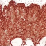 Tonsil: Cytokeratin (AE1/AE3 (m), ImmPRESS Reagent (HRP), ImmPACT NovaRED Substrate (red).