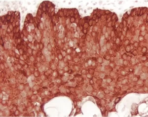 Tonsil: Cytokeratin (AE1/AE3 (m), ImmPRESS Reagent (HRP), ImmPACT NovaRED Substrate (red).