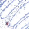 Colon Peripherin m Vp p Immpress Anti mouse Ig Kit Immpact Novared red Substrate Hematoxylin Qs blue Counterstain Colon Peripherin m Vp p Immpress Anti mouse Ig Kit Immpact Novared red Substrate Hematoxylin Qs blue Counterstain
