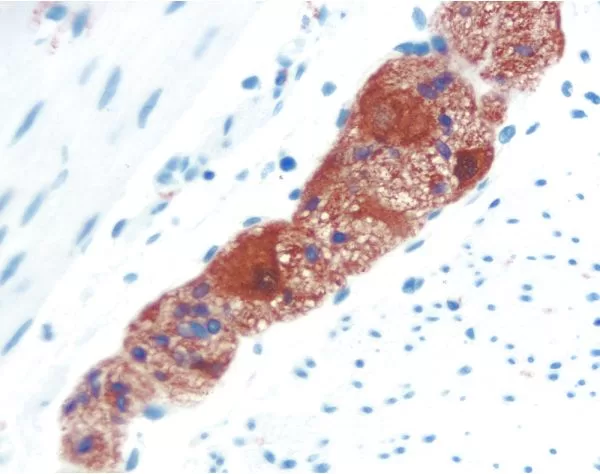 Colon: PGP 9.5 (m, VP-P983), ImmPRESS Anti-Mouse Ig Kit, ImmPACT AEC (red) substrate. Hematoxylin QS (blue) counterstain.