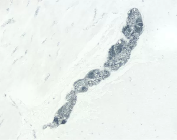 Colon: PGP 9.5 (m, VP-P983), ImmPRESS Anti-Mouse Ig Kit, ImmPACT SG (blue-gray) substrate.