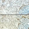 Sections of rat spleen stained with a mouse antibody to Desmin and detected with a rat adsorbed or non-rat adsorbed ImmPRESS Anti-Mouse Ig Kit: ImmPRESS Anti-Mouse Ig Kit (Rat Adsorbed), top, ImmPRESS Anti-Mouse Ig (non-rat adsorbed), bottom; DAB (brown)