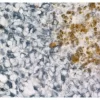 Melanoma was stained with anti-vimentin followed by ImmPRESS™ HRP Anti-Rabbit IgG Reagent and Vector SG Substrate. Note the excellent contrast of the substrate with the brown pigments.