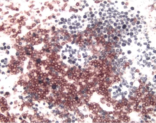 Tonsil (double label): CD3 (m), ImmPRESS Anti-Mouse Ig Reagent, Vector NovaRED substrate (red); Ki67 (m), ImmPRESS Anti-Mouse Ig Reagent, Vector DAB+Ni substrate (gray/black).
