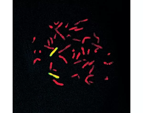 Human chromosome 6 paint detected with FITC-labeled probe (yellow) and mounted with VECTASHIELD Mounting Medium with PI (red) Photo courtesy of Cytocell Ltd.