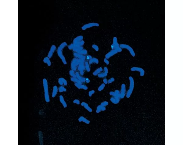 Single copy DNA probe to the Downs region of chromosome 21 using FITC-labeled antibody (green) and mounted in VECTASHIELD Mounting Medium with DAPI (blue) - Photo courtesy of Cytocell Ltd.