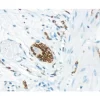 Small bowel: CD56 (m), VECTASTAIN Universal Elite ABC Kit, ImmPACT DAB (brown) substrate. Hematoxylin QS counterstain (blue).
