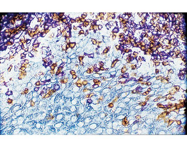 Tonsil triple stained using the VECTASTAIN Universal Elite ABC Kit: T cells (brown, DAB), B cells (purple, Vector VIP), epithelium (blue/gray, Vector SG).