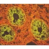Frozen section of colon viewed under fluorescein filter: Lycopersicon esculentum lectin (orange staining with Vector Red) and glandular epithelium (green fluorescein label).