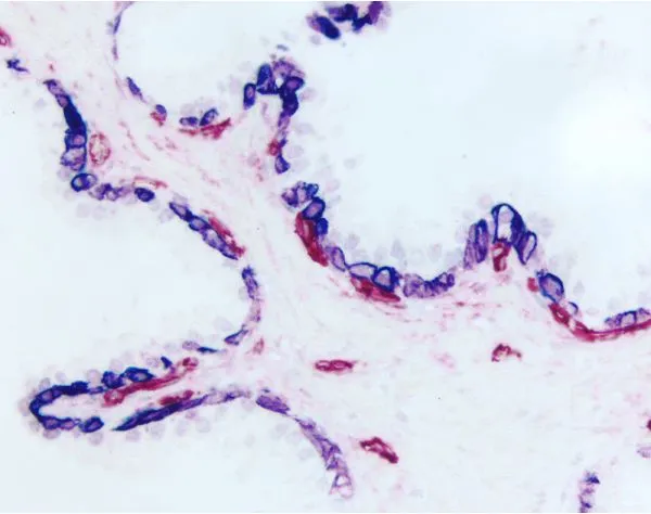 Prostate (double label): Cytokeratin (m), VECTASTAIN ABC-AP Kit, Vector Blue (blue) substrate. CD34, VECTASTAIN ABC-AP Kit, Vector Red (red) substrate.
