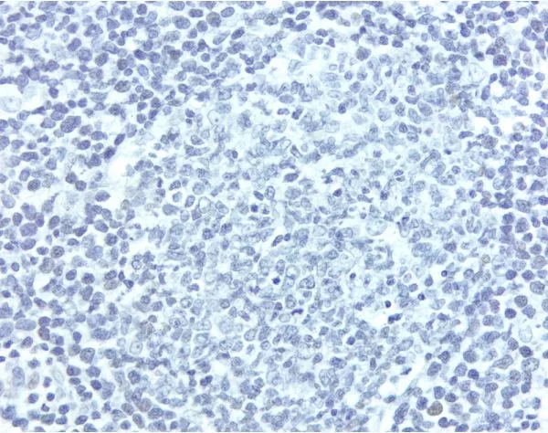 Lymph Node: With pH 9.0 Antigen Unmasking Solution, Cyclin D1 (rm), ImmPRESS Anti-Rabbit Ig Kit, DAB (brown) substrate. Hematoxylin QS (blue) counterstain.