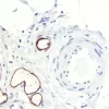 Colon Submucosa Lymphatic Endothelium Stained Using Mouse Monoclonal Antibody Against Ma Antigen clone D Cat No Vp m Immpress Anti mouse Ig Reagent mp and Vector Novared Peroxidase Substrate sk Red Hematoxylin Qs Countersta Colon Submucosa Lymphatic Endothelium Stained Using Mouse Monoclonal Antibody Against Ma Antigen clone D Cat No Vp m Immpress Anti mouse Ig Reagent mp and Vector Novared Peroxidase Substrate sk Red Hematoxylin Qs Countersta
