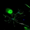 Astrocytes: Stained for GFAP and detected with Dylight 488 labeled secondary antibody. Mounted in VECTASHIELD HardSet Mounting Medium with DAPI. Image courtesy of Dr Emma East, Department of Life Sciences, The Open University, U.K.*