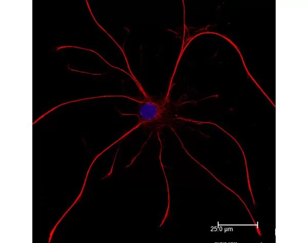 Astrocytes: Stained for GFAP and detected with Dylight 549 labeled secondary antibody. Mounted in VECTASHIELD HardSet Mounting Medium with DAPI. Image courtesy of Dr Emma East, Department of Life Sciences, The Open University, U.K.*