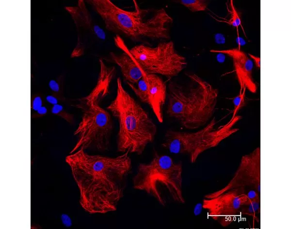 Astrocytes: Stained for GFAP and detected with Dylight 594 labeled secondary antibody. Mounted in VECTASHIELD HardSet Mounting Medium with DAPI. Image courtesy of Dr Emma East, Department of Life Sciences, The Open University, U.K.*