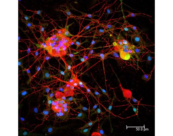 Dorsal root ganglia cells (neurons and satellite glia) - double label. BIII tubulin, DyLight 549 labeled secondary antibody (red). S100, DyLight 488 labeled secondary antibody (green). Mounted in VECTASHIELD HardSet Mounting Medium with DAPI. Image courte