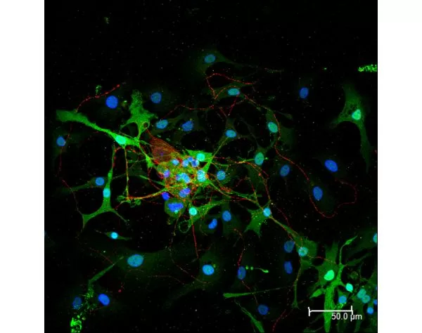 Dorsal root ganglia cells (neurons and satellite glia) - double label. BIII tubulin, DyLight 488 labeled secondary antibody (green). S100, DyLight 594 labeled secondary antibody (red). Mounted in VECTASHIELD HardSet Mounting Medium with DAPI. Image courte