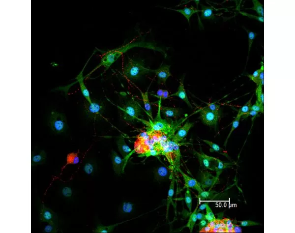 Dorsal root ganglia cells (neurons and satellite glia) - double label. BIII tubulin, DyLight 549 labeled secondary antibody (orange). S100, DyLight 488 labeled secondary antibody (green). Mounted in VECTASHIELD HardSet Mounting Medium with DAPI.